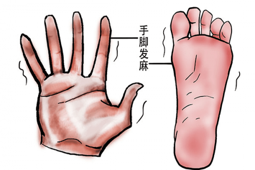 手腳經常發麻是什么原因?手腳發麻可能患有哪些疾?。? /></span></p><p style=